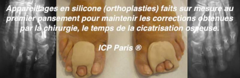 Suites opératoires Griffe d'orteil